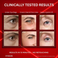 Eye Bag Instant Eraser